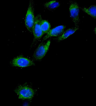 AEBP2 Rabbit Polyclonal Antibody