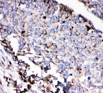 AEBP2 Rabbit Polyclonal Antibody