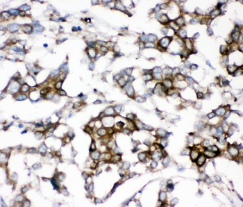 AEBP2 Rabbit Polyclonal Antibody