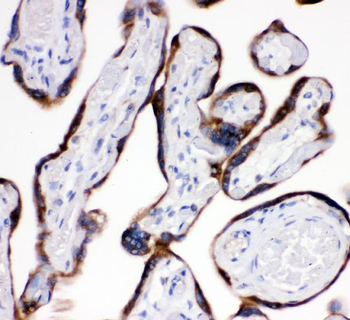 AEBP2 Rabbit Polyclonal Antibody
