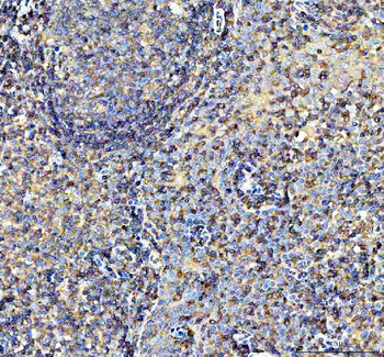 AIRE Rabbit Polyclonal Antibody
