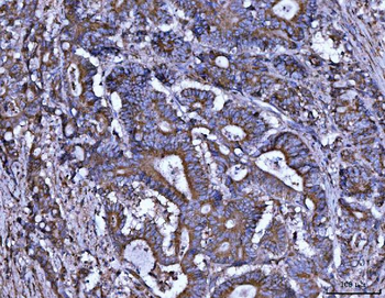 ALDH1A2 Rabbit Polyclonal Antibody