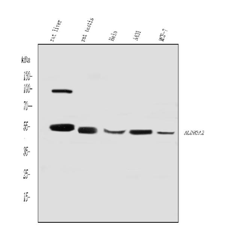 ALDH3A2 Rabbit Polyclonal Antibody