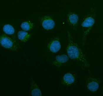 AMACR Rabbit Polyclonal Antibody
