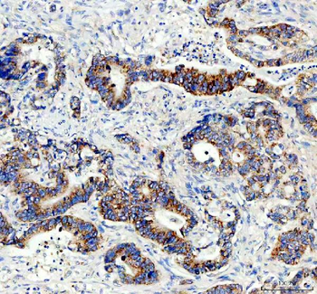 AMACR Rabbit Polyclonal Antibody