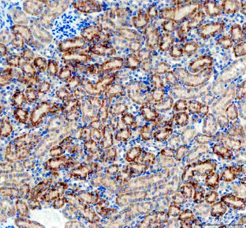 AMACR Rabbit Polyclonal Antibody