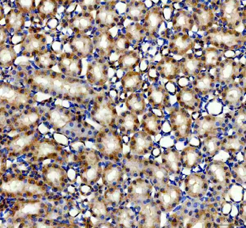 AMACR Rabbit Polyclonal Antibody