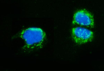 AMHR2 Rabbit Polyclonal Antibody