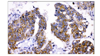 AMHR2 Rabbit Polyclonal Antibody