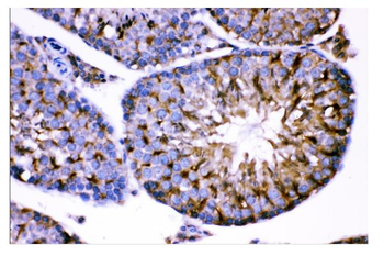 AMHR2 Rabbit Polyclonal Antibody
