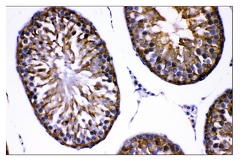 AMHR2 Rabbit Polyclonal Antibody