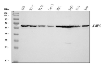 AMHR2 Rabbit Polyclonal Antibody