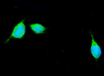 Apolipoprotein E/APOE Rabbit Polyclonal Antibody