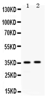 Apolipoprotein E/APOE Rabbit Polyclonal Antibody