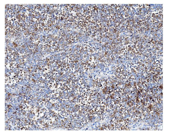 ARF6 Rabbit Polyclonal Antibody