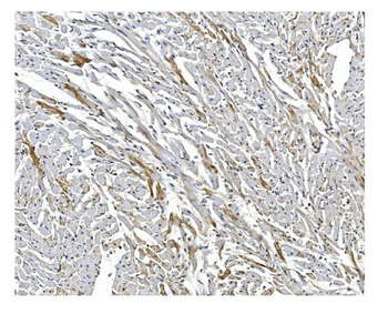 ARF6 Rabbit Polyclonal Antibody