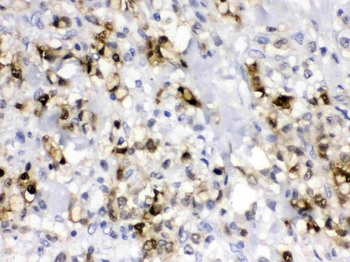 Carbonic Anhydrase II/CA2 Rabbit Polyclonal Antibody