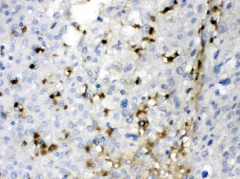 Carbonic Anhydrase II/CA2 Rabbit Polyclonal Antibody