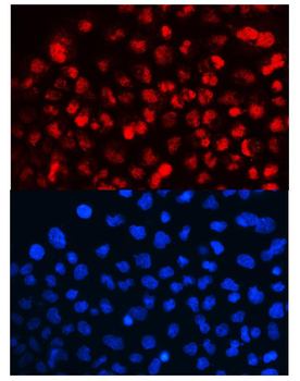 Cyclin T1/CCNT1 Rabbit Polyclonal Antibody