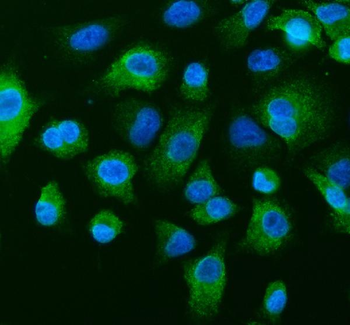 TCP1 theta/CCT8 Antibody
