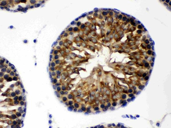 TCP1 theta/CCT8 Antibody