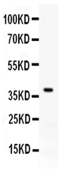 PD-L1/CD274/PD Rabbit Polyclonal Antibody