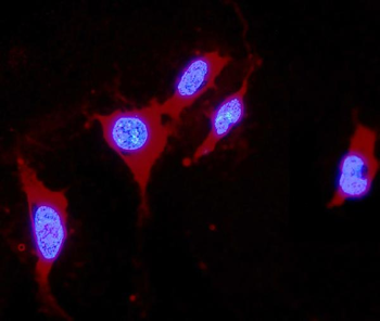 DDAH1 Rabbit Polyclonal Antibody