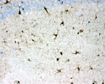 DDAH1 Rabbit Polyclonal Antibody