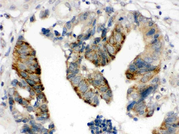 HMGB2 Rabbit Polyclonal Antibody
