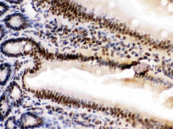 HMGB2 Rabbit Polyclonal Antibody