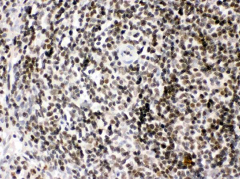 HMGB2 Rabbit Polyclonal Antibody