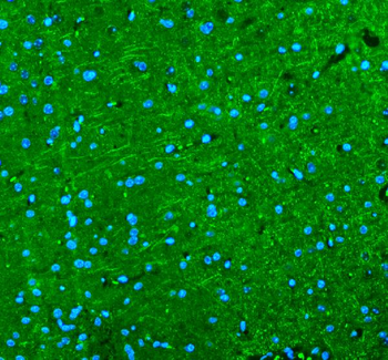 Alpha Internexin/INA Rabbit Polyclonal Antibody