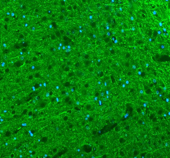 Alpha Internexin/INA Rabbit Polyclonal Antibody