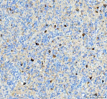 Alpha Internexin/INA Rabbit Polyclonal Antibody