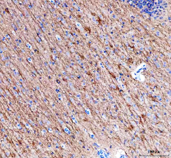 Alpha Internexin/INA Rabbit Polyclonal Antibody