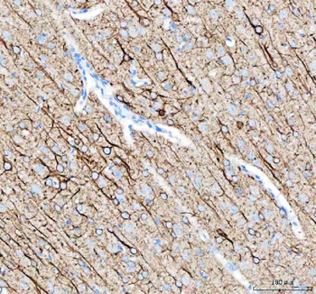 Alpha Internexin/INA Rabbit Polyclonal Antibody