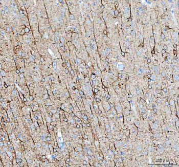 Alpha Internexin/INA Rabbit Polyclonal Antibody