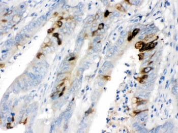 ITLN1 Rabbit Polyclonal Antibody