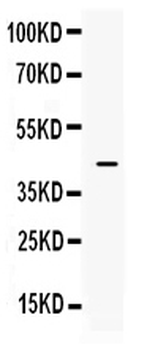 ITLN1 Rabbit Polyclonal Antibody