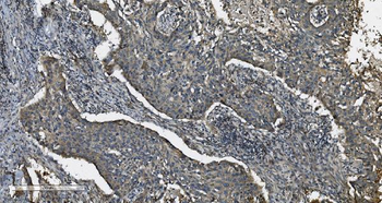 MAP3K8 Rabbit Polyclonal Antibody