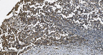 MAP3K8 Rabbit Polyclonal Antibody