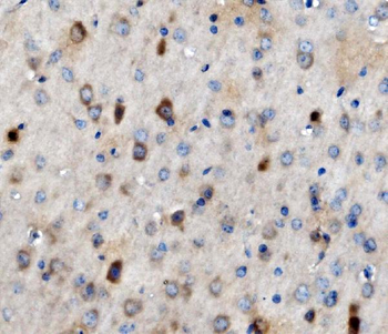 MAP3K8 Rabbit Polyclonal Antibody