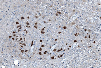 MAP3K8 Rabbit Polyclonal Antibody