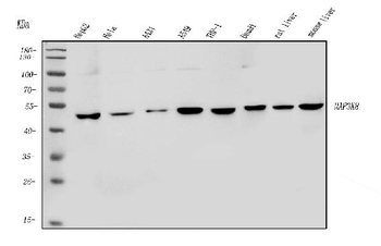 MAP3K8 Rabbit Polyclonal Antibody
