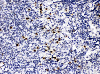 MMP9 Rabbit Polyclonal Antibody