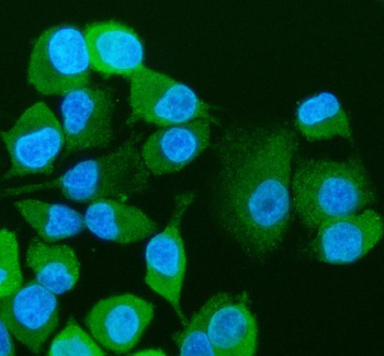 Visfatin/NAMPT Rabbit Polyclonal Antibody