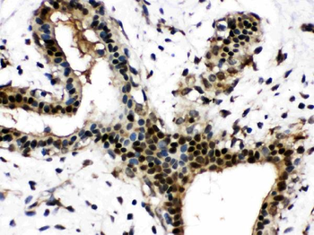 Visfatin/NAMPT Rabbit Polyclonal Antibody