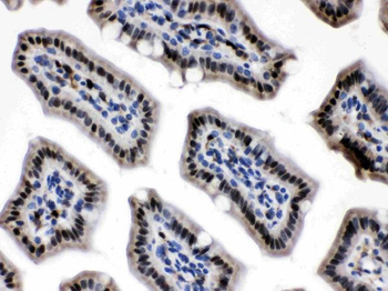 Visfatin/NAMPT Rabbit Polyclonal Antibody