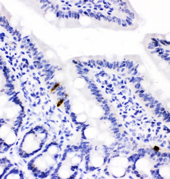 Peptide YY/PYY Rabbit Polyclonal Antibody