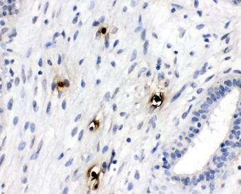 Mast Cell Tryptase/TPSAB1 Rabbit Polyclonal Antibody